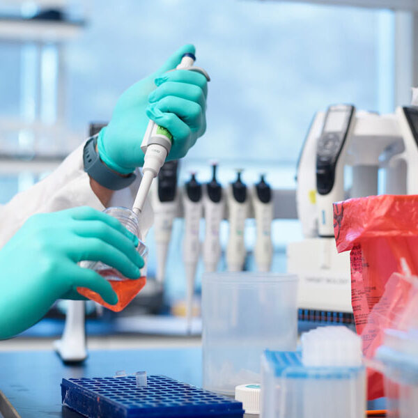 Mural employee hands studying immunotherapy with bright blue gloves using lab equipment