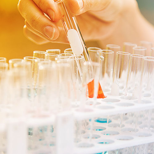 Lab science research glass items adding drop to one of several test tubes.